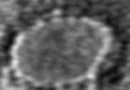 वैज्ञानिकों ने कोरोना वायरस की माइक्रोस्कोप से ली तस्वीर